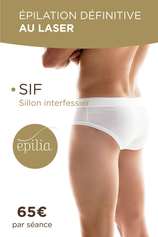 epilation-laser-sif-homme-waterloo-mob